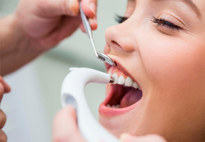 Профессиональная чистка зубов: ответы на часто задаваемые вопросы